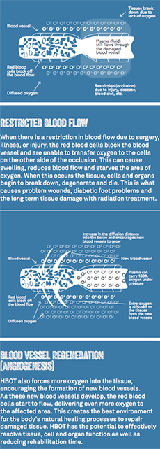 Oxygen Healing Process Explained